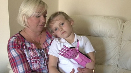 英國5歲殘疾女童成功安裝3D打印手掌（圖）