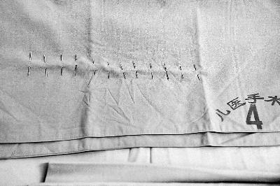 圖為女嬰體內12根鋼針昨天全被取出，將作為警方調查證據