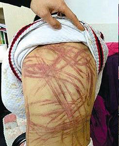 圖為被虐打男童