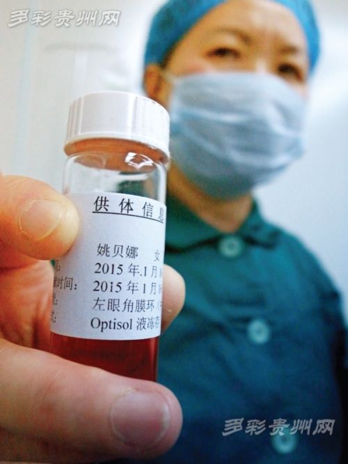 　　姚貝娜的眼角膜。