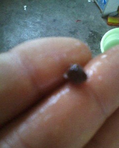 青島達(dá)利園八寶粥喝出石塊硌斷牙 客服:還有其他異物 青島達(dá)利園八寶粥喝出石塊硌斷牙 客服:還有其他異物