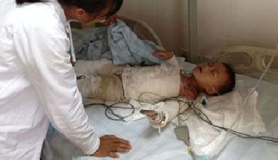 男童落入熱水桶 寶寶身邊“離世隱形殺手”知多少