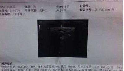 一歲男童被診懷孕 父母懷疑其患罕見疾病