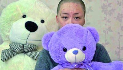 毀容少女坐地鐵被看哭 索賠360萬挽不回失去的青春