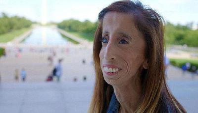 “世界最丑女人”現(xiàn)身電影節(jié) 反對網(wǎng)絡(luò)欺凌