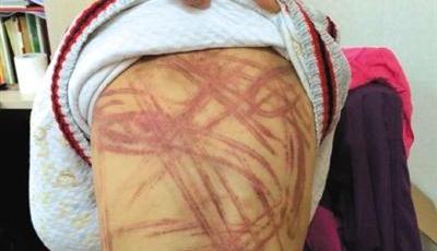 南京遭虐待男童養父母系高知 警方介入調查(圖)