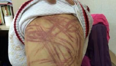 南京虐童案追蹤 養父是律師 養母與生母系表姐妹