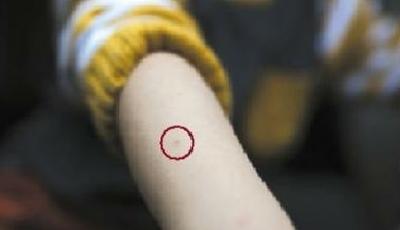 北京一幼兒園女老師針扎多名幼童被拘