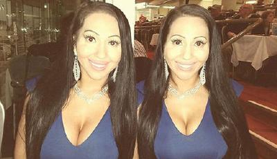 全球最像雙胞胎25萬整形確保一樣 共享工作和男友