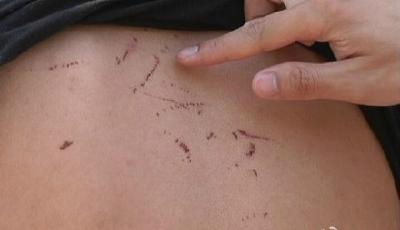 替閨蜜“出頭” 4名90后女老師圍毆18歲男學生 