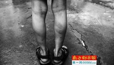 小學生不愿“補課”遭班主任暴打 全家被罵沒文化