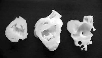 3D打印心臟模型救活先心病嬰兒 為國內首例