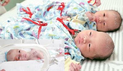 32歲二胎母親誕三胞胎 概率低至百萬分之一
