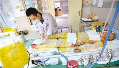 14歲少女為救父親返回火場 全身燒傷面積達79%