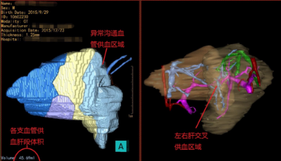 海信醫療CAS系統獲業界大咖“力挺”