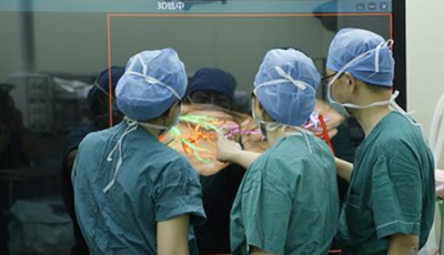 海信醫療助力復旦兒科實現全國第三例計算機輔助連體嬰兒分離