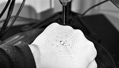 皮膚上首次直接打印出3D電子元件