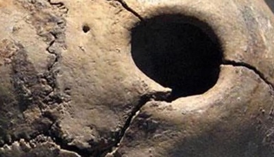 從新石器時代到扁鵲看現在，山東醫學到底有多發達？丨這就是山東