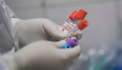 上海昨日新增2例新冠肺炎本土确诊病例